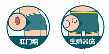 上海bet必威网址_HPV科普知识